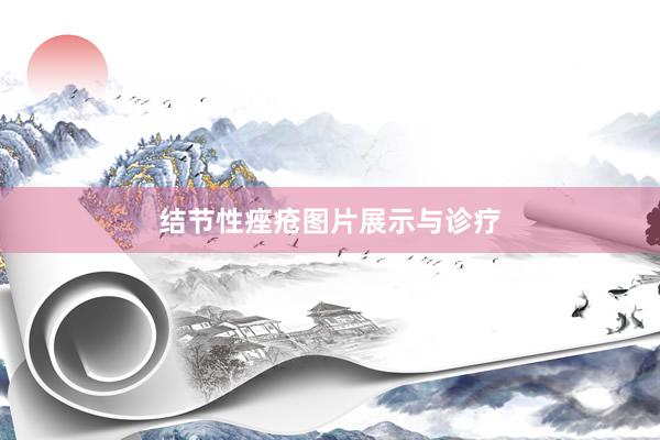 结节性痤疮图片展示与诊疗